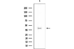 Western blot analysis of lysates from COLO205 cells, using DOK4 Mouse Monoclonal Antibody at 1/1000 dilution.