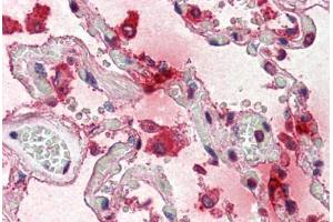 Human Lung (formalin-fixed, paraffin-embedded) stained with TPSAB1 antibody ABIN337204 at 5 ug/ml followed by biotinylated anti-mouse IgG secondary antibody ABIN481714, alkaline phosphatase-streptavidin and chromogen. (TPSAB1 anticorps)
