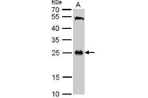 WB Image GSTT1 antibody detects GSTT1 protein by Western blot analysis.