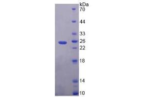 Image no. 1 for Phosphatidylethanolamine Binding Protein 1 (PEBP1) (AA 2-187) protein (His tag) (ABIN4990570)