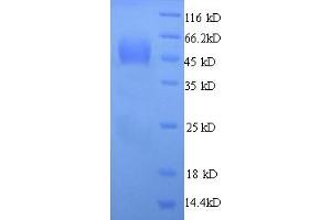 SDS-PAGE (SDS) image for Syndecan 1 (SDC1) (AA 23-257), (Extracellular) protein (His tag) (ABIN5713814)