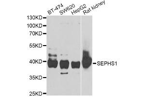 Western blot analysis of extracts of various cell lines, using SEPHS1 antibody (ABIN5973853) at 1/1000 dilution. (SEPHS1 anticorps)