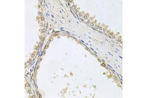 Immunohistochemistry of paraffin-embedded human prostate using POMGNT1 antibody (ABIN6003611) at dilution of 1/100 (40x lens). (POMGNT1 anticorps)