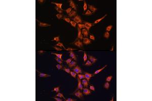 Immunofluorescence analysis of C6 cells using PFDN5 Rabbit pAb (ABIN1681328, ABIN3018415, ABIN3018416 and ABIN6220463) at dilution of 1:100 (40x lens). (PFDN5 anticorps  (AA 1-154))