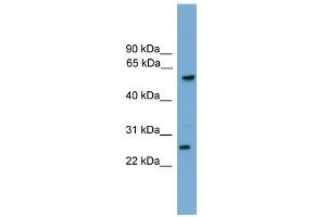 GZMA antibody used at 0. (GZMA anticorps  (C-Term))