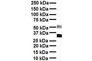 WB Suggested Anti-SCN8A antibody Titration: 1 ug/mL Sample Type: Human heart