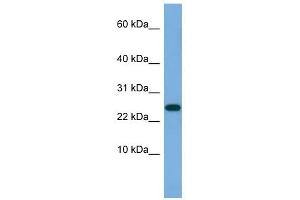 ANKRD39 antibody used at 0. (ANKRD39 anticorps  (N-Term))