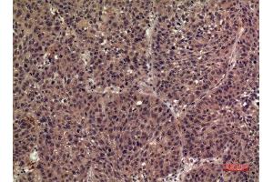 Immunohistochemistry (IHC) analysis of paraffin-embedded Human Lung, antibody was diluted at 1:100. (FIL1h anticorps  (Internal Region))