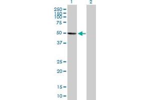 Western Blot analysis of KIAA0141 expression in transfected 293T cell line by KIAA0141 MaxPab polyclonal antibody. (DELE1/KIAA0141 anticorps  (AA 1-515))