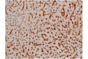 ABIN6267385 at 1/200 staining Mouse liver tissue sections by IHC-P.