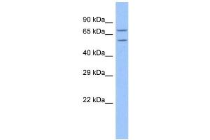 WB Suggested Anti-TRAP1 Antibody Titration: 1. (TRAP1 anticorps  (N-Term))
