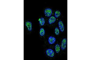 Confocal immunofluorescent analysis of ZN Antibody (Center) (ABIN653731 and ABIN2843038) with HepG2 cell followed by Alexa Fluor 488-conjugated goat anti-rabbit lgG (green). (ZNF202 anticorps  (AA 342-370))