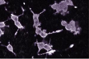 Immunofluorescence staining of PC12 cells (Rat neuroblastoma, ATCC CRL-1721). (PKC alpha anticorps  (AA 270-427))