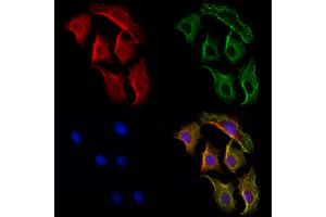 ABIN6264457 and ABIN6272976 staining Hela cells by IF/ICC. (PSAT1 anticorps  (Internal Region))