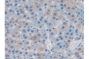 Detection of RANkL in Rat Liver Tissue using Polyclonal Antibody to Receptor Activator Of Nuclear Factor Kappa B Ligand (RANkL)