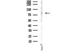 anti-Transmembrane Channel-Like 8 (TMC8) (C-Term) antibody