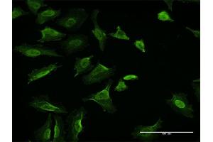 Immunofluorescence of monoclonal antibody to VCL on HeLa cell.