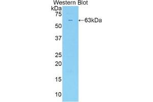 Detection of Recombinant SULF2, Human using Polyclonal Antibody to Sulfatase 2 (SULF2)