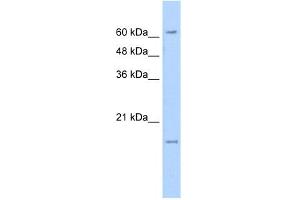 WB Suggested Anti-SLC13A3 Antibody Titration:  5. (SLC13A3 anticorps  (N-Term))