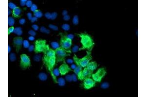 Image no. 5 for anti-SUMO1/sentrin/SMT3 Specific Peptidase 2 (SENP2) (AA 139-523) antibody (ABIN1490926) (SENP2 anticorps  (AA 139-523))