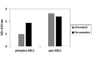 Jurkat cells were treated with Pervanadate. (ABL1 Kit ELISA)