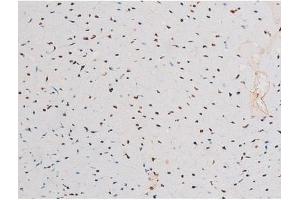 ABIN6267601 at 1/200 staining Mouse heart tissue sections by IHC-P.