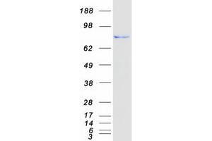 Validation with Western Blot