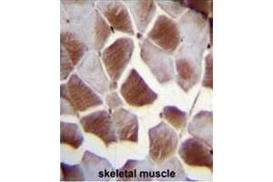 EIF2B4 Antibody (Center K161) immunohistochemistry analysis in formalin fixed and paraffin embedded human skeletal muscle followed by peroxidase conjugation of the secondary antibody and DAB staining.