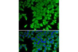 Immunofluorescence analysis of U2OS cells using CRABP2 Polyclonal Antibody (CRABP2 anticorps)