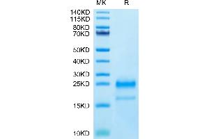 Interleukin 4 (IL4) (AA 25-153) protein (His tag)