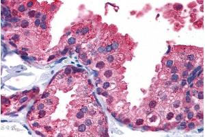 ABIN185574 (5µg/ml) staining of paraffin embedded Human Prostate. (PDE4B anticorps  (C-Term))