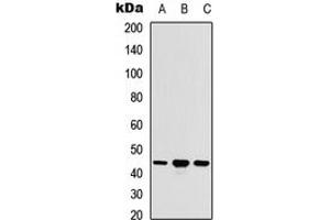 Western blot analysis of ACOT9 expression in HEK293T (A), Raw264. (ACOT9 anticorps  (Center))