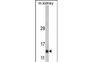 Western blot analysis of DNAJC19 Antibody (Center) (ABIN390453 and ABIN2840826) in mouse kidney tissue lysates (35 μg/lane).