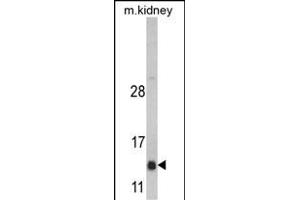 Western blot analysis of DNAJC19 Antibody (Center) (ABIN390453 and ABIN2840826) in mouse kidney tissue lysates (35 μg/lane). (DNAJC19 anticorps  (AA 55-84))