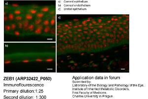 Image no. 3 for anti-Zinc Finger E-Box Binding Homeobox 1 (ZEB1) (N-Term) antibody (ABIN2779631) (ZEB1 anticorps  (N-Term))