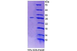 SDS-PAGE analysis of Mouse LRP1B Protein. (LRP1B Protéine)