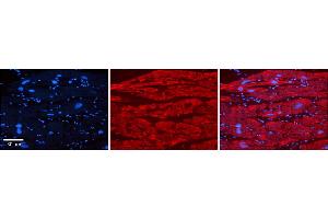Rabbit Anti-TRIM10 Antibody    Formalin Fixed Paraffin Embedded Tissue: Human Adult heart  Observed Staining: Cytoplasmic Primary Antibody Concentration: 1:600 Secondary Antibody: Donkey anti-Rabbit-Cy2/3 Secondary Antibody Concentration: 1:200 Magnification: 20X Exposure Time: 0.