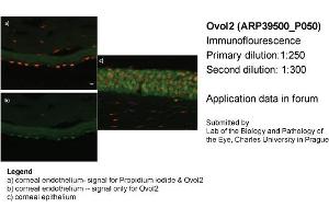 Image no. 2 for anti-Ovo-Like 2 (OVOL2) (Middle Region) antibody (ABIN405245) (OVOL2 anticorps  (Middle Region))