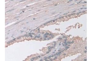 Detection of GAMT in Human Prostate Tissue using Polyclonal Antibody to Guanidinoacetate-N-Methyltransferase (GAMT)