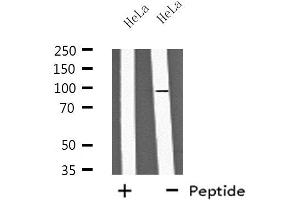 Western blot analysis of extracts from HeLa cells, using PA2G6 antibody. (PLA2G6 anticorps  (Internal Region))