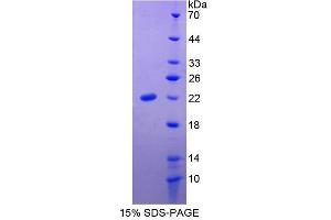 SDS-PAGE analysis of Human Slit Homolog 3 Protein. (SLIT3 Protéine)