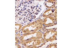 (ABIN652075 and ABIN2840539) staining CUX1 in human kidney tissue sections by Immunohistochemistry (IHC-P - paraformaldehyde-fixed, paraffin-embedded sections).
