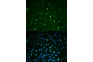 Immunofluorescence analysis of U2OS cells using Phospho-H2AFX-S139 antibody (ABIN5969940). (H2AFX anticorps  (pSer139))