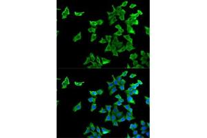 Immunofluorescence analysis of U2OS cells using HTR2B antibody (ABIN6127310, ABIN6142069, ABIN6142070 and ABIN6221320). (Serotonin Receptor 2B anticorps  (AA 382-481))