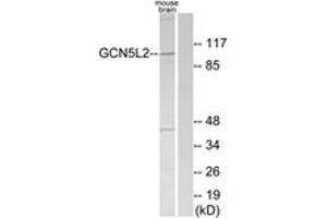 Western blot analysis of extracts from mouse brain cells, using GCN5L2 Antibody.
