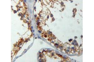 IHC-P analysis of testis tissue, with DAB staining. (CRAT anticorps  (AA 1-430))
