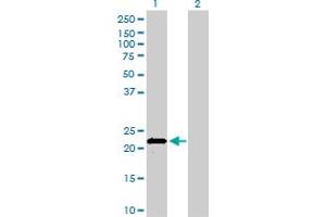 Western Blot analysis of APOM expression in transfected 293T cell line by APOM monoclonal antibody (M01), clone 1F10.