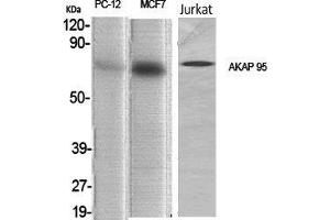 Western Blot (WB) analysis of specific cells using AKAP 95 Polyclonal Antibody. (AKAP8 anticorps  (Internal Region))