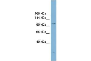 WB Suggested Anti-ACLY Antibody Titration:  0. (ACLY anticorps  (Middle Region))