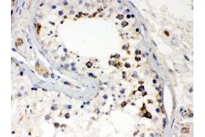 Smac/Diablo was detected in paraffin-embedded sections of human testis tissues using rabbit anti- Smac/Diablo Antigen Affinity purified polyclonal antibody at 1 μg/mL. (DIABLO anticorps  (AA 56-239))